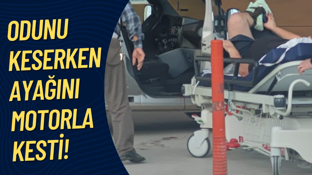Odun keserken ayağını motorla kesti