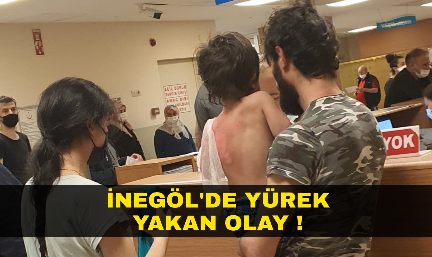 Üzerine kaynar su dökülen çocuk yaralandı !