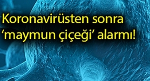 Maymun Çiçeği Virüsü Alarm Veriyor !