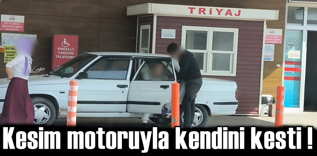 Kesim motoruyla kendini kesti !